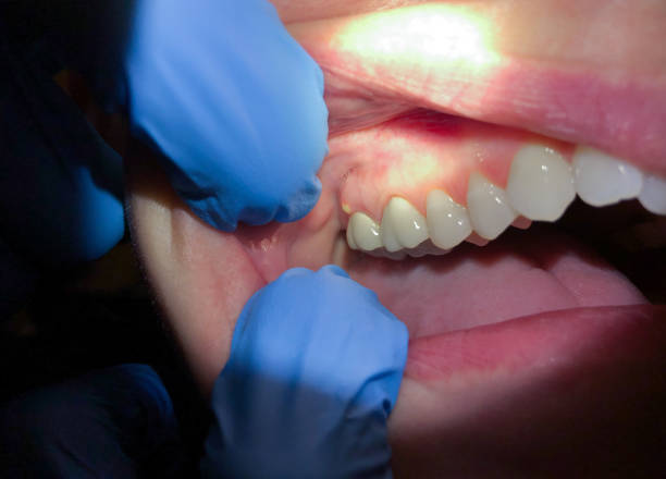 Best Emergency Dental Care for Trauma or Injury in Decatur, IL